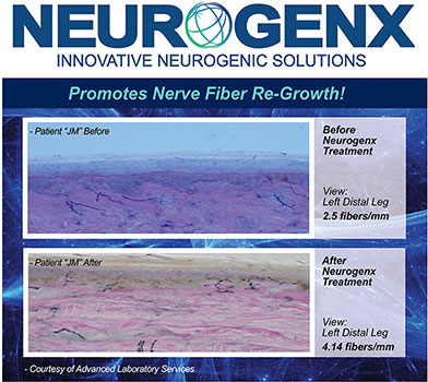 neurogenx treatment